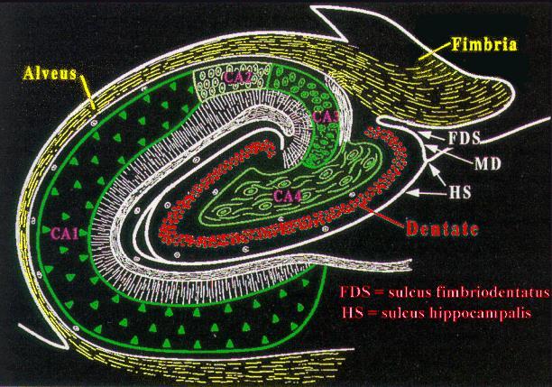 Mammillare atrophia MRI 1. Atrophy 2.