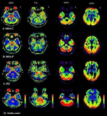 Neuroradiology 2011; 53: 471-81