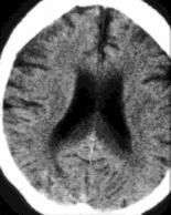 encephalopathia: 26 éves férfi