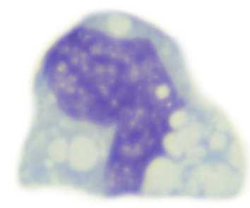 microglia, alveolaris macrophag phagocyták, cytokineket is