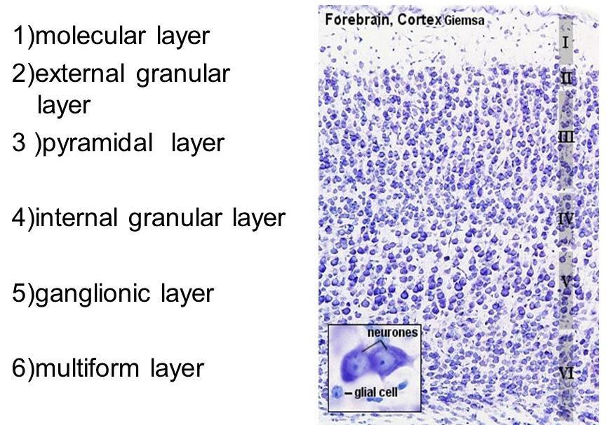 MEDULLOBLASTOMA - a kisagyi precursor sejtek sejtdús embryonalis tumora [a subependymalis matrix őssejtjeiből és a kisagy external granularis rétéből (EGL) ] - az esetek 5%-ban genetikai öröklődő