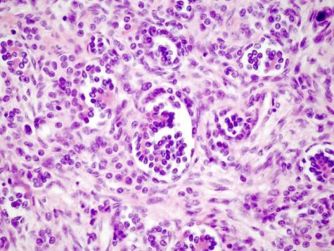 elemek Epithelialis sejtek glomerulus és