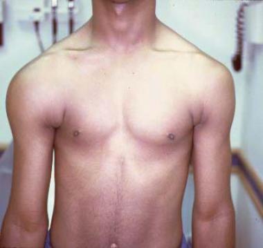http://emedicine.medscape.