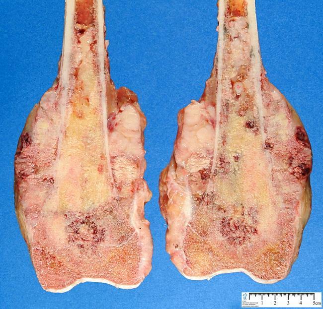 Mehlman, DO, MPH; Chief Editor: Harris Gellman, MD