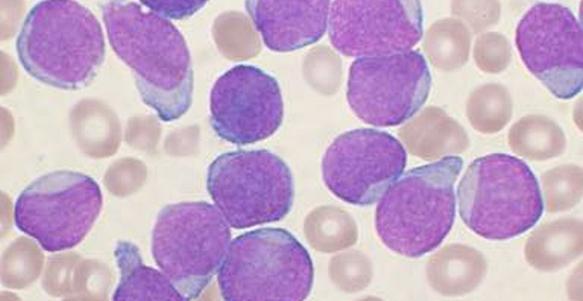 thymus https://www.2minutemedicine.com 1. Pre-B sejtek TdT-t expressz{lnak (terminal deoxytransferase=dns polymersae) 2. Nincs felszíni Ig expresszió 3.