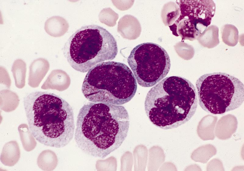 Auer p{lc{k azurophil granulumok