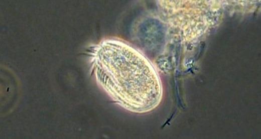 9. ábra: Euplotes sp. (fénykép: R. Miseta). A győri levegőztető medencék kumulatív oszlopdiagramján az éves mikrobaközösségek az alábbi módon oszlanak el (10. ábra).