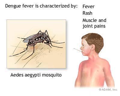 Dengue