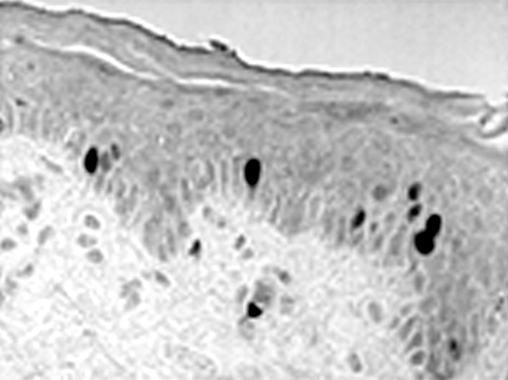 megtartó), sima felszínû, egyszerû citoplazmájú sejt, a másik gyors egymásutánban osztódó, felszínén kitüremkedéseket viselõ, komplexebb citoplazmájú sejttípus (Lavker Sun, 1982).