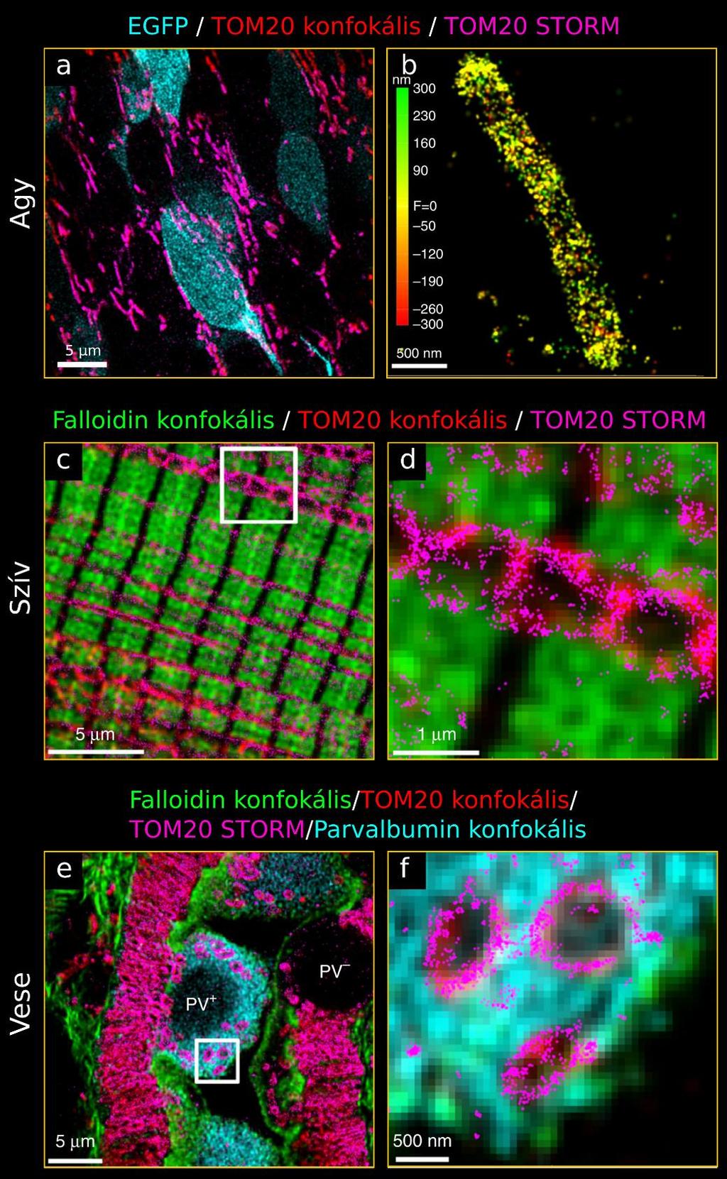 34. ábra Korrelatív konfokális és STORM képalkotás különböző szövetekben és jelölésekkel.