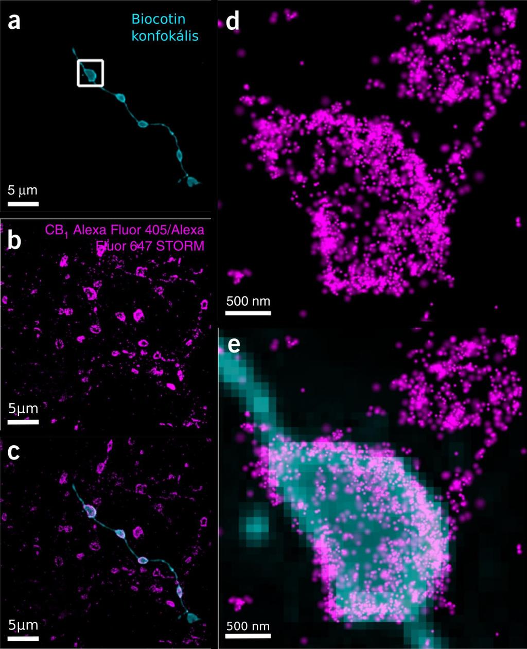 24. ábra Korrelatív konfokális és STORM képalkotás. (a) Biocitinnel töltött axonszakasz dekonvolvált konfokális képalkotással megjelenítve.