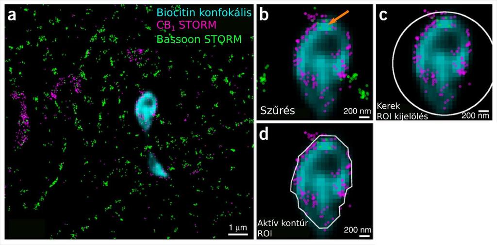 lokalizációkat. A legegyszerűbb módszer az, hogy a VividSTORM szabadkezes kijelölő eszközével körberajzoljuk a szubcelluláris profilt például esetünkben a boutont.