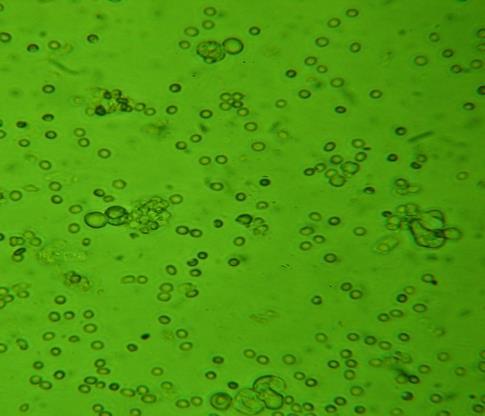 In vivo alkalmazott elsővonalbeli kemoterápiás és promethazine (PIP) kombinációs PEHE kezelések hatására a sejtproliferációs gyakoriság (17.