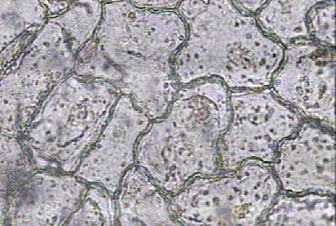 ábra. A felső epidermiszt