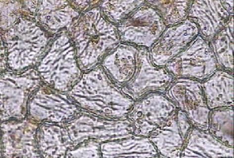 epidermiszek vastagságát