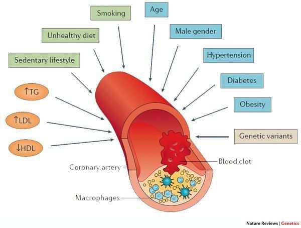 dohányzás, magas vérnyomás) és öröklött (LDL receptor gén mutáció) faktorok egyaránt szerepet játszanak.