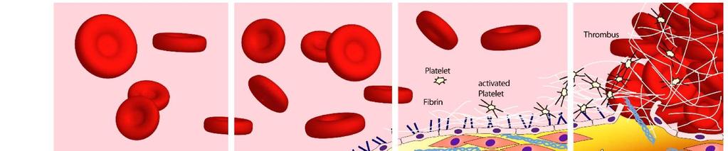 atherosclerosis endothelsérülésre adott