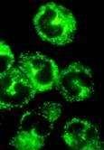 máj-vese microsoma