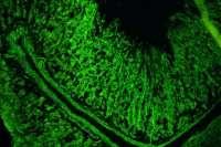 Kidney Microsoma