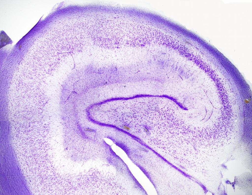 Hippocampus kapcsolatai: Triszinaptikus kör: Bemenet perforáns pálya az entorhinális kéregből Granulasejteken végződik. Azok axonjai a moharostok a CA3 piramissejteket idegzik be.