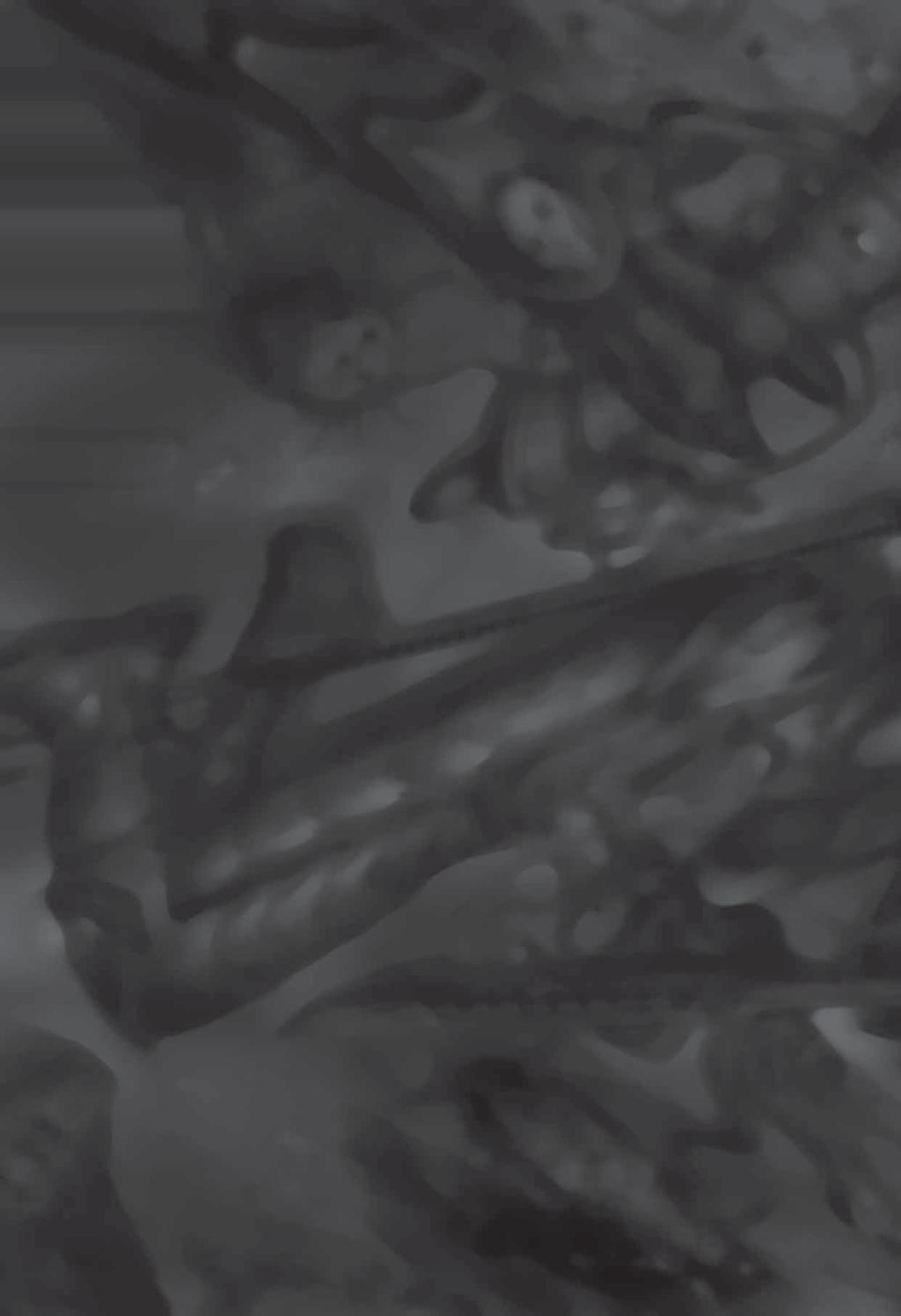 II DUNGEON FÓKUSZ ADVANCED DUNGEONS SIEGE Dohos, vértől mocskos és sötét kazamaták, rothadó élőhalottak, vérszomjas démonok, sok-sok küldetés és hentelés vár ránk a 2002- ben megjelent nagysikerű