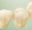 n Mill (FONA Dental s.r.o.