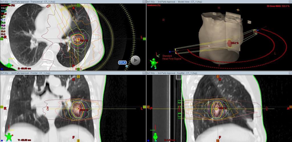 Stereotactic ablative