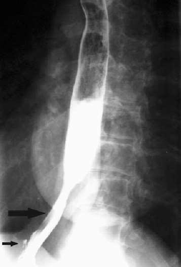 Státusz rögzítés Vérkép Máj-vesefunkció proteinuria, hematuria Képalkotó vizsgálatok.