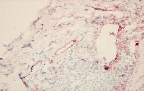 Distinct phenotypes in mixed connective tissue disease:subgroups and survival.