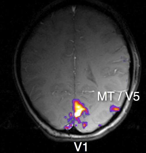 responsiveness of various brain regions to complex stimuli.