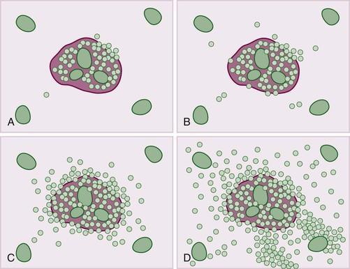 com/acute-and-chronic-infectious-hepatitis/#s0095