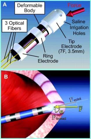 katéter-elektróda között IN VIVO KONTAKT-ERŐ MÉRÉS a