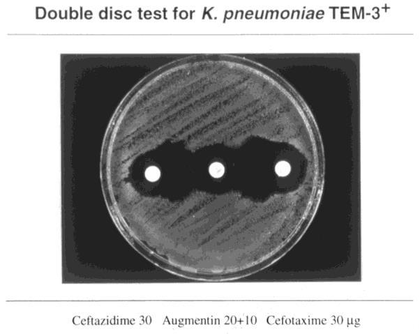 Kettős korong szinergia teszt (DDST) Cefotaxim 30μg (ceftriaxon,