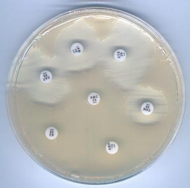 Amp C típusú rezisztencia III. generációs cephalosporinok, ureidopenicillinek, carboxypenicillinek hatására ún.