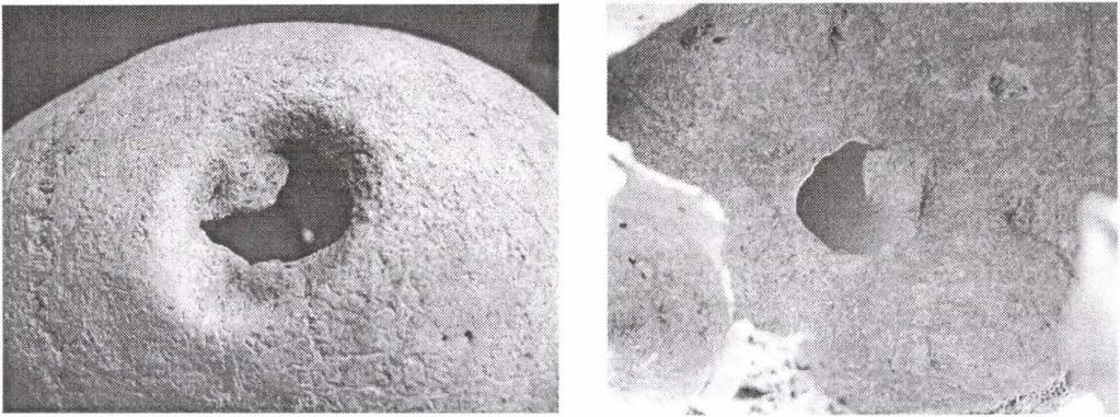 5. ábra: Traumás elváltozás a koponyán (8. sír, maturus férfi). Figure 5: Traumatic changes on the skull (grave 8, mature male). Irodalom Acsádi, Gy., Nemeskéri, J.