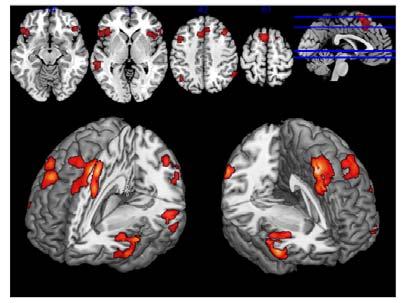 ) The VLPFC initiates the appraisal and signals the need to regulate the emotion to the DLPFC c.