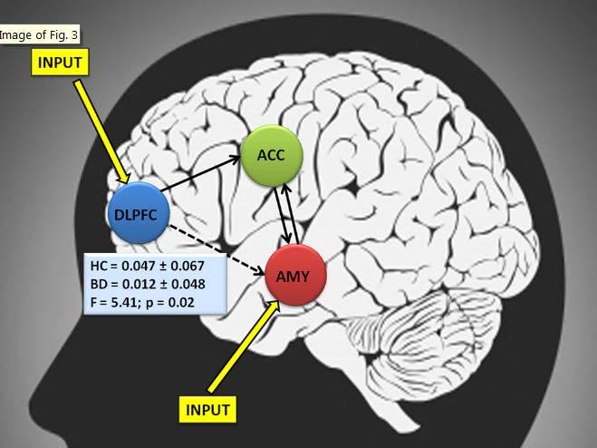 Fronto-limbic disconnection in bipolar disorder Decreased effective connectivity between dorsolateral prefrontal cortex and amygdala during emotion labeling in bipolar disorder.