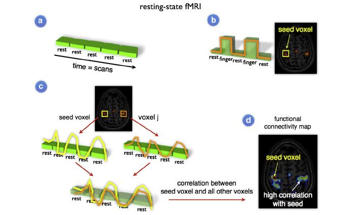 Resting state fmri és elemzése Agyunk sosem csendes Folyamatos tüzelési minták Folyamatos fluktuáció a BOLD válaszban Resting state hálózatok