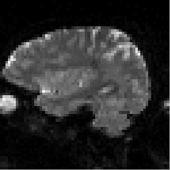 fmri Előfeldolgozás 1.