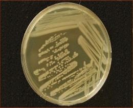 mikroelemek Felvehető (N,P,K, tápelemek (10- Mg,Mn,Fe,B,Zn,Cu,Mo) féle) Pseudomonas baktériumok Oxigén, bioszén (0,5%, 14 kg/ha), táp-elemek!