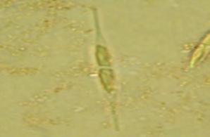 ábra: A Tisza középső folyásának néhány jellemző faja a Kiskörei vízlépcső létesítése előtt: Cyclotella meneghiniana, Nitzschia acicularis, Asterionella formosa, Diatoma vulgaris A Tisza-tó és a
