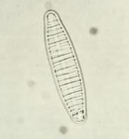 Áll egyrészt a potamoplanktonban is előforduló valódi euplanktonikus szervezetekből, mint a Nitzschia acicularis, Synedra acus, Fragilaria crotonensis, Asterionella formosa, Nitzschia holsatica,