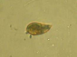 Cyanophyta Cianobaktériumok 43 Euglenphyta Ostoros moszatok 107 Pyrrophyta Barázdás moszatok 27 Chrysophyceae Sárgamoszatok 35 Xanthophyceae Sárgászöld moszatok 7 Bacillariophyceae Kovamoszatok 158