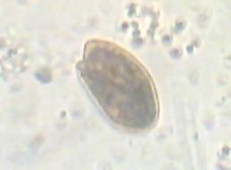 Strombomonas schauinslandii Heterokonthophyta Anabaena spiroides Trachelomonas oblonga Chrysophyceae Gomphosphaeria lacustris Trachelomonas volvocina Chrysococcus biporus Merismopedia tenuissima