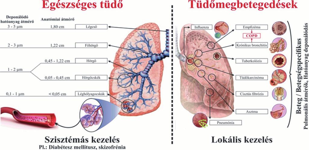 Előzmények A pulmonális témával kapcsolatosan, a szerzők több közleményt is megjelentettek a Gyógyszerészet hasábjain az utóbbi években.