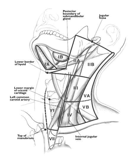 A nyaki régió ultrahang vizsgálata - Dr. Binó Brúnó