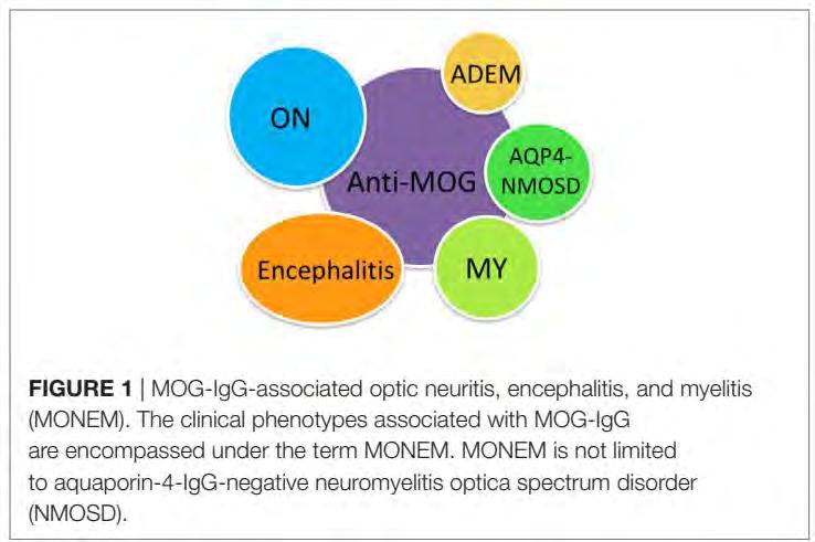 MOG + betegek Klinikai spektrum: ADEM recurráló és bilateralis ON transvers myelitis (önállóan ritkább), ON+myelitis gyakoribb Más autoimmun betegséggel való társulás ritka Gyors válasz steroidra és