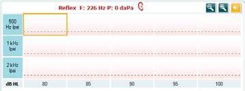 Titan használati útmutató HU Page 65 Az időtartamot jelölő csúszkán a stimulus hosszát 10, 15, 20, 25 és 30 másodpercre állíthatja be manuális reflex fáradás vizsgálatnál.