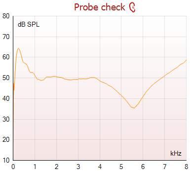 Titan használati útmutató HU Page 79 A Response graph (Válaszgrafikon) a mérőmikrofon által rögzített választ (db SPL) mutatja a frekvencia (Hz) függvényében.