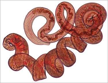 Decreased atopy in children infected with Schistosoma haematobium: a role for parasiteinduced interleukin-10 The Lancet,2000 www.ed.ac.